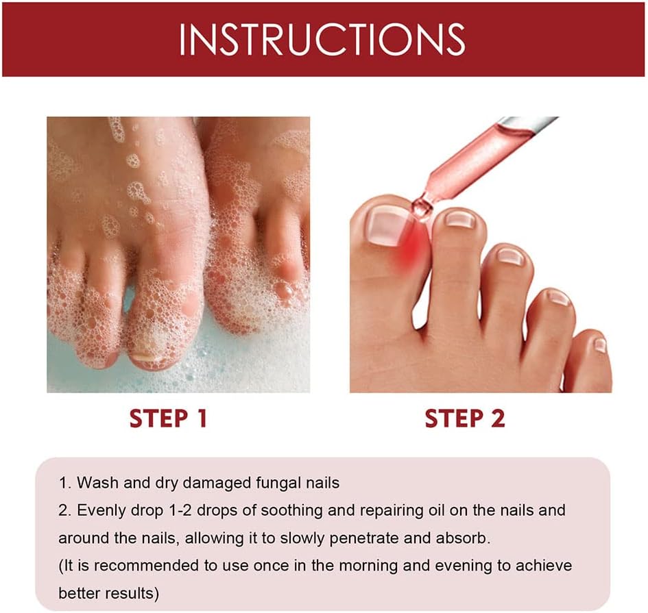 HealDrop™ - Regenerate Damaged Nails in 4 Weeks