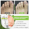 1+1 FREE | RejuveNail™ Powerful Nail Repair: Strong, Healthy Nails!