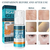 1+1 FREE | ScarEase™ Smooths Skin Texture!