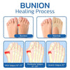 1+1 FREE | SoothePlus™ These comfortable socks soothe your foot pain effectively