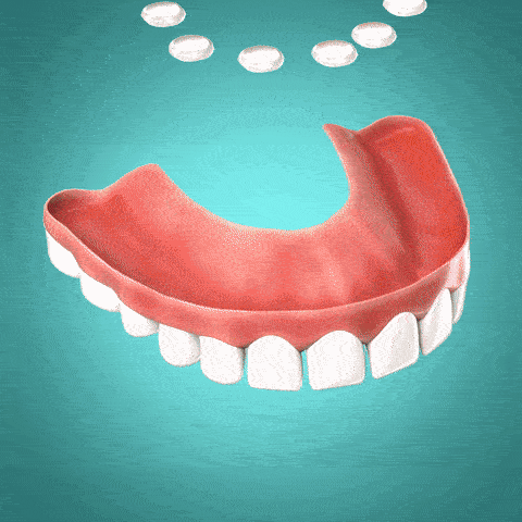 SiliconeAdjust™ - Silicone Set for Dental Prostheses