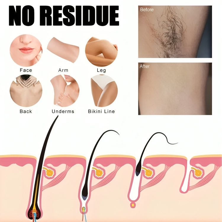 1+1 FREE | FreshBare Mist™ Pain-Free Hair Removal for Silky, Healthy Skin