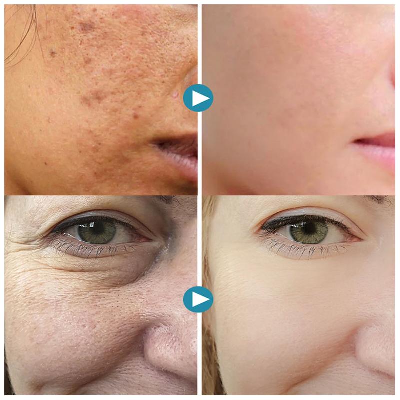 1+1 FREE | PoreGel™ For Flawless Skin That Lasts All Day!