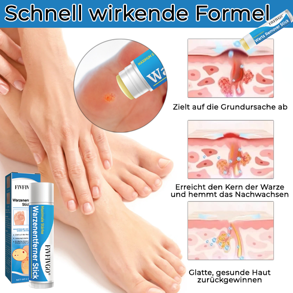 1+1 FREE | DermaCare™ Quick Wart Removal