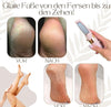CallusPro™ - Electric Callus Remover