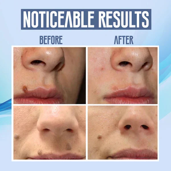 Spotfree Electric Beauty Brush