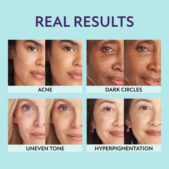 1+1 Free | SupremeCrème™ – All-Day Radiance that Nourishes and Refines Your Skin