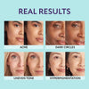 1+1 Free | SupremeCrème™ – All-Day Radiance that Nourishes and Refines Your Skin