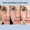 1+1 FREE | YouthLift Renew Strips™ Combat Fine Lines and Sagging Skin in Minutes