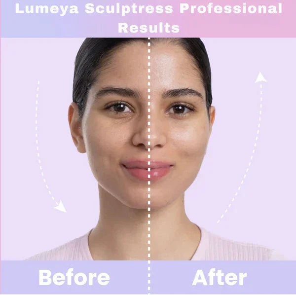 GlowEase™ - Reduces Puffiness and Fine Lines!