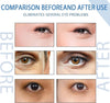 1+1 FREE | Luminize™ A clinically proven solution for annoying eye wrinkles and fine lines