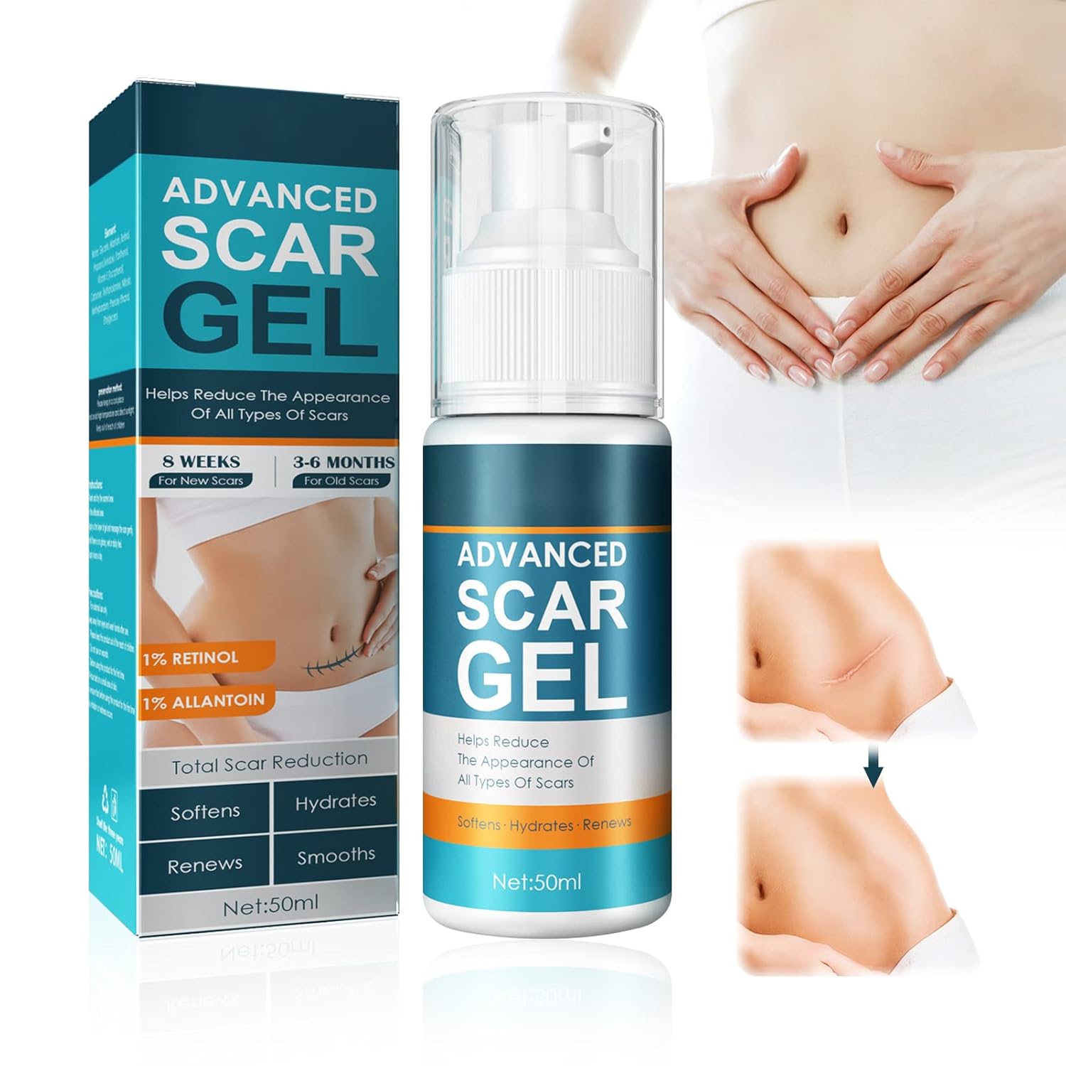 1+1 FREE | ScarEase™ Smooths Skin Texture!