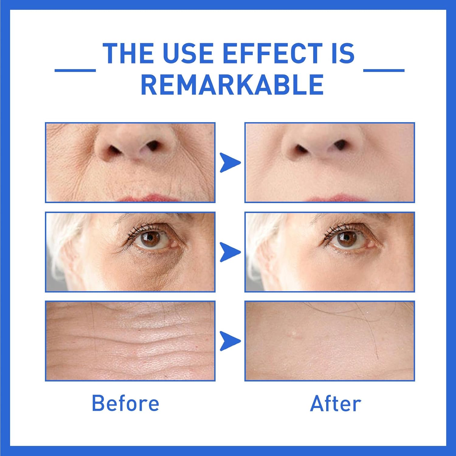1+1 FREE | Botanique™ For a More Youthful Appearance Without Surgery