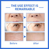 1+1 FREE | Botanique™ For a More Youthful Appearance Without Surgery