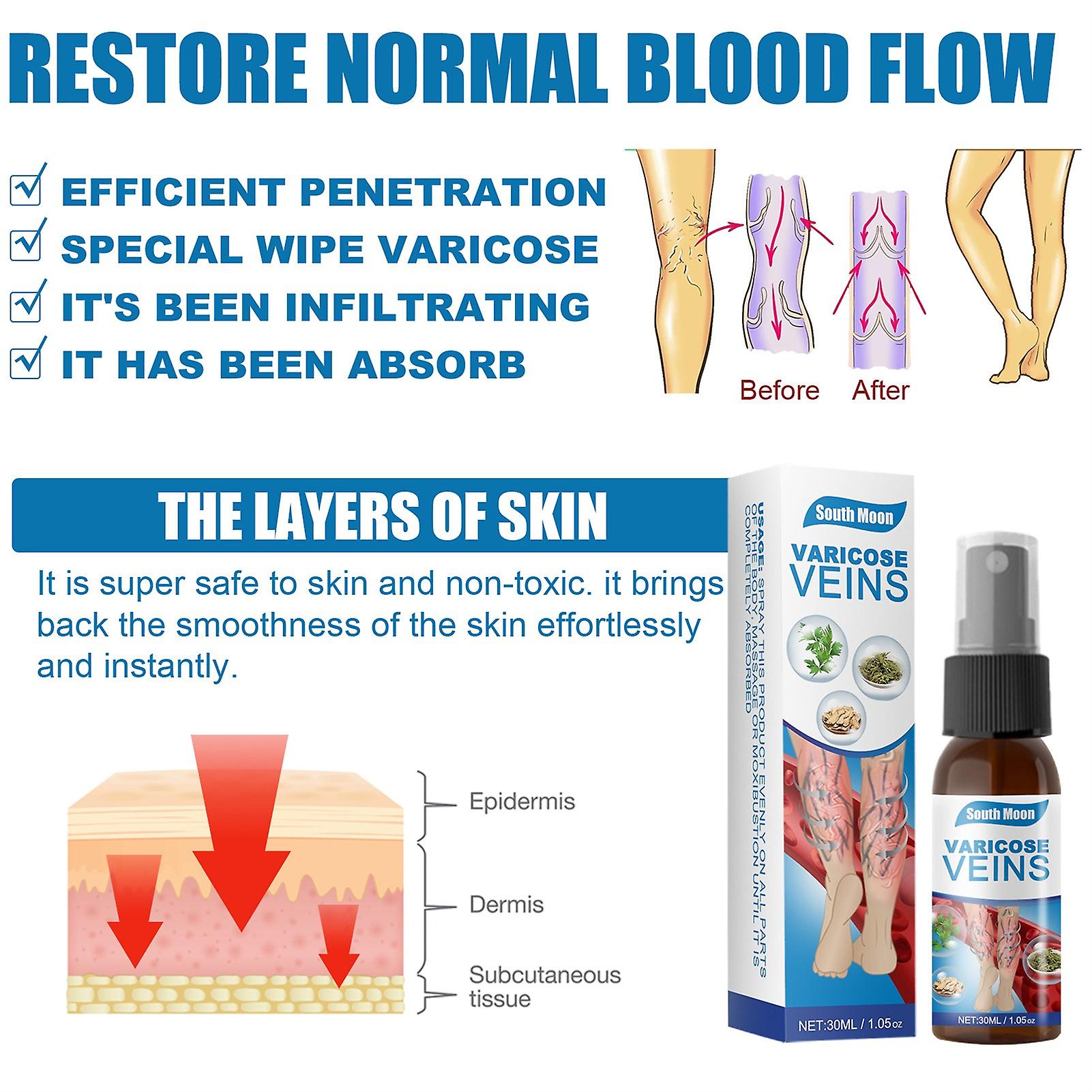 1+1 Free | Varicose Vein Spray™ - Treat varicose veins without surgery!