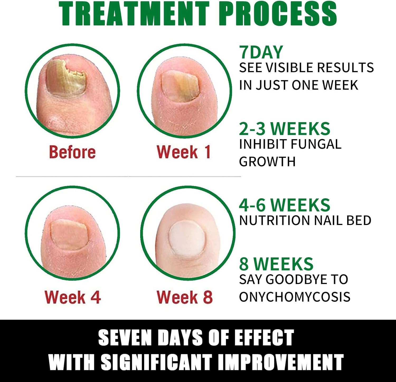 FungiGone™ - For Healthy, Beautiful Nails Without Fungus