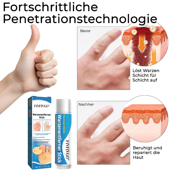 1+1 FREE | DermaCare™ Quick Wart Removal