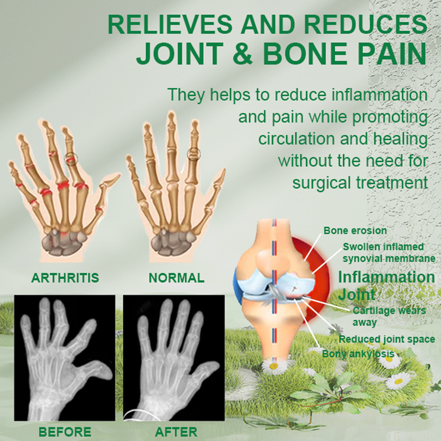 1+1 FREE | Pain Relief Gel™ Say goodbye to persistent joint pain!