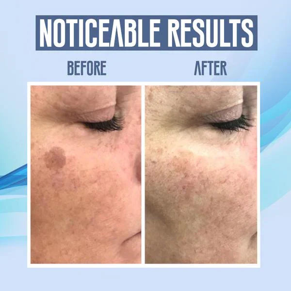 DarkBlotch™ — Removes impurities for flawless, radiant skin every day