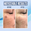 DarkBlotch™ — Removes impurities for flawless, radiant skin every day