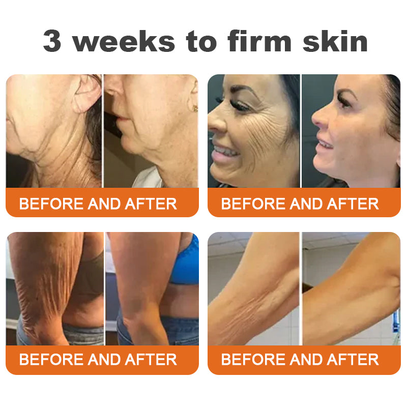 1+1 Free | LOVILDS™ Botulinum Toxin Honey Gift Tightening Serum Stick – Transform Your Skin in Just 7 Days with Firmness and Youthful Radiance