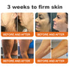 1+1 Free | LOVILDS™ Botulinum Toxin Honey Gift Tightening Serum Stick – Transform Your Skin in Just 7 Days with Firmness and Youthful Radiance