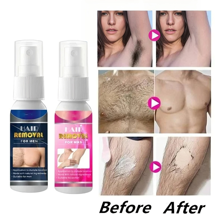 1+1 FREE | FreshBare Mist™ Pain-Free Hair Removal for Silky, Healthy Skin