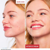 1+1 FREE | SkinPerfect™ — Reveals smooth, radiant skin that heals and shines all day
