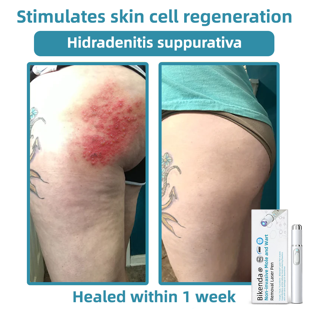 LumiDerm™ – Reveal Radiant, Flawless Skin and Achieve Quick Confidence