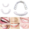 InstaSmile™ —  Instant Confidence With A Perfect Smile