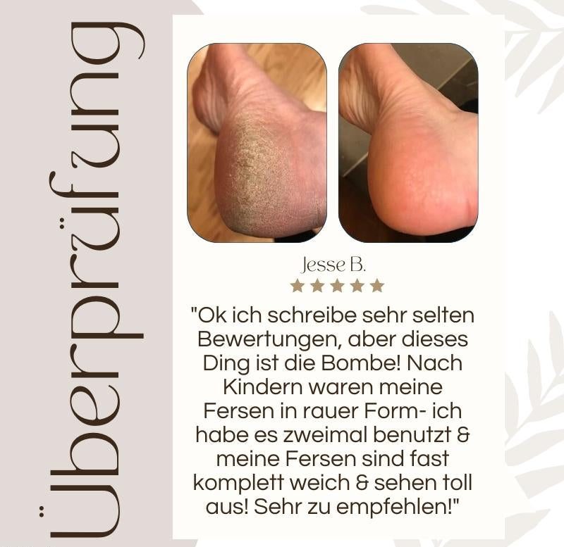 CallusPro™ - Electric Callus Remover