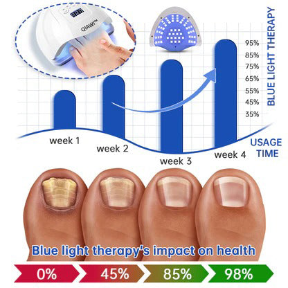 FungusX™ - Fungus Therapy Device