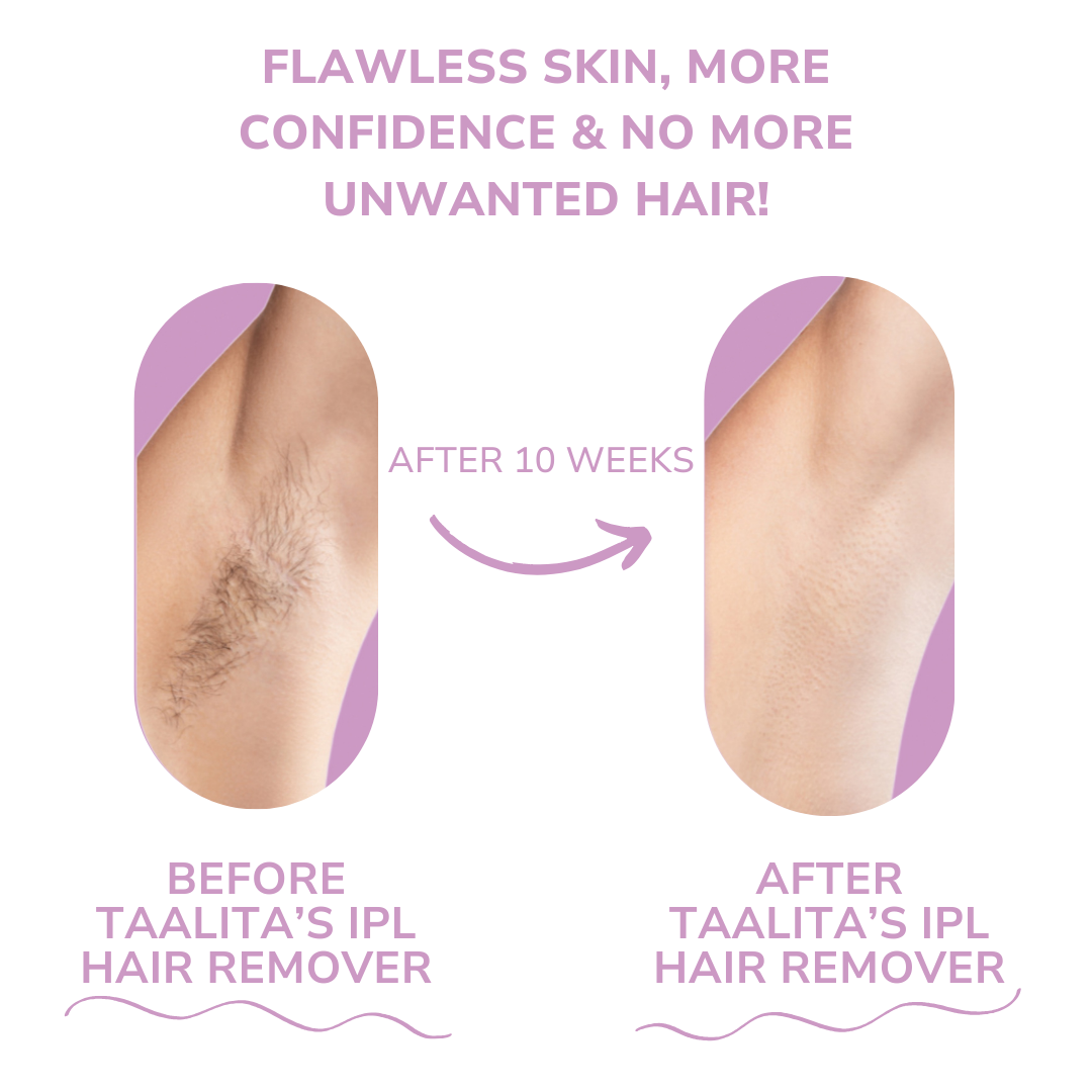 LumaSilk™ – Achieve Effortless Smoothness In The Comfort Of Your Home