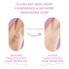 LumaSilk™ – Achieve Effortless Smoothness In The Comfort Of Your Home