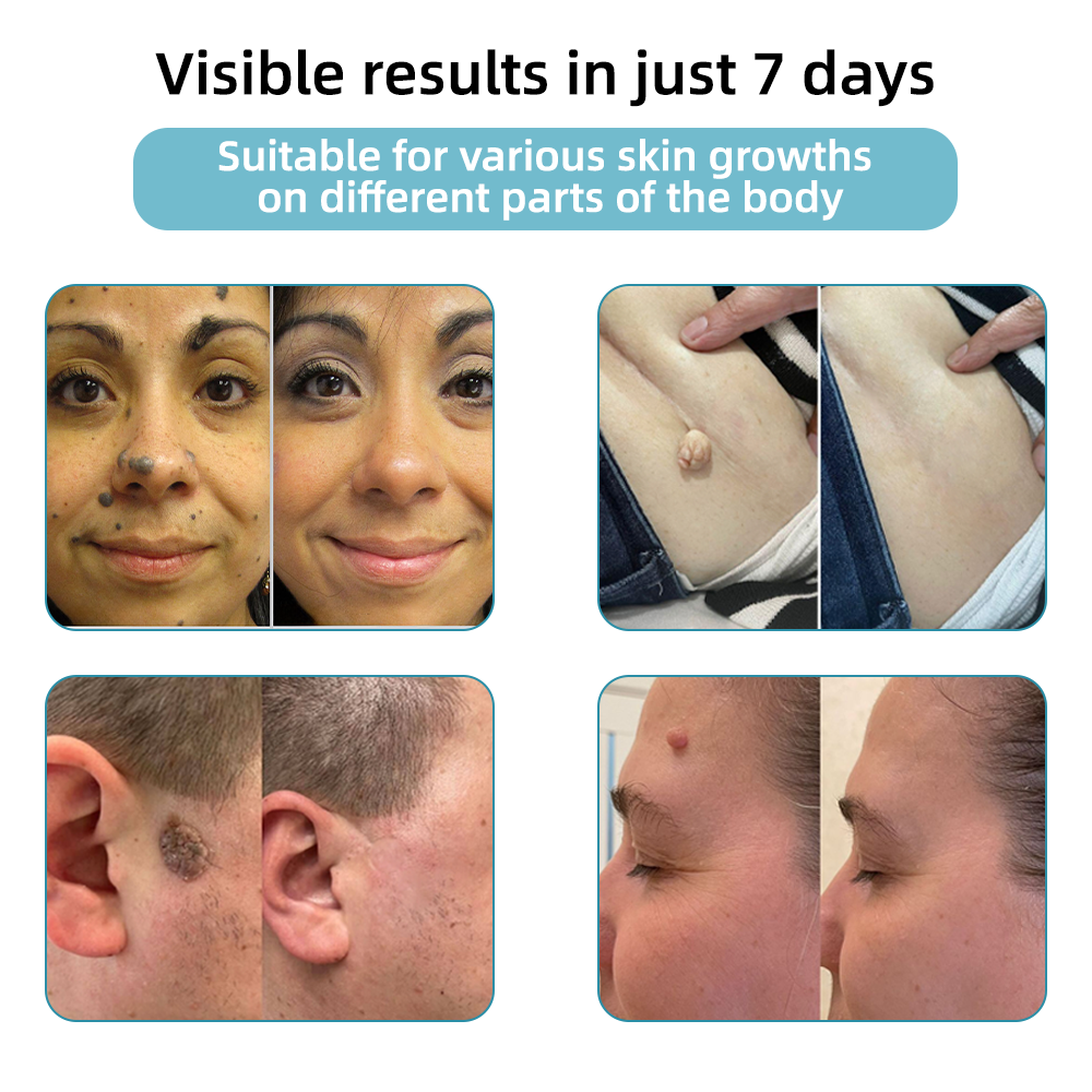 LumiDerm™ – Reveal Radiant, Flawless Skin and Achieve Quick Confidence