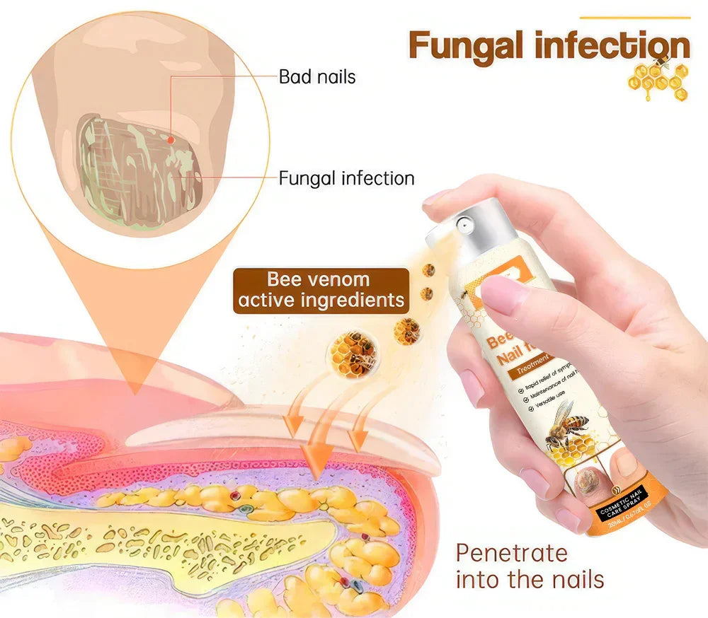 1+1 FREE | Venomix™ Say goodbye to nail fungus in just 2 weeks!