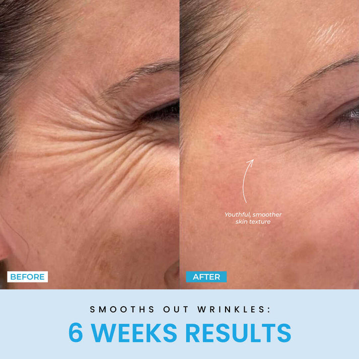 ContourVive™ – Tighten and Define Your Jawline for Timeless Confidence