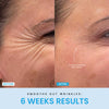 ContourVive™ – Tighten and Define Your Jawline for Timeless Confidence