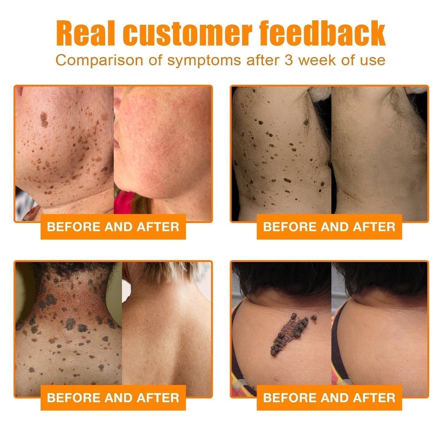 1+1 Free | NEWYOU™ TagLift Neck Gift Treatment — Painless Skin Renewal for Clear, Confident Skin