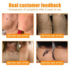1+1 Free | NEWYOU™ TagLift Neck Gift Treatment — Painless Skin Renewal for Clear, Confident Skin