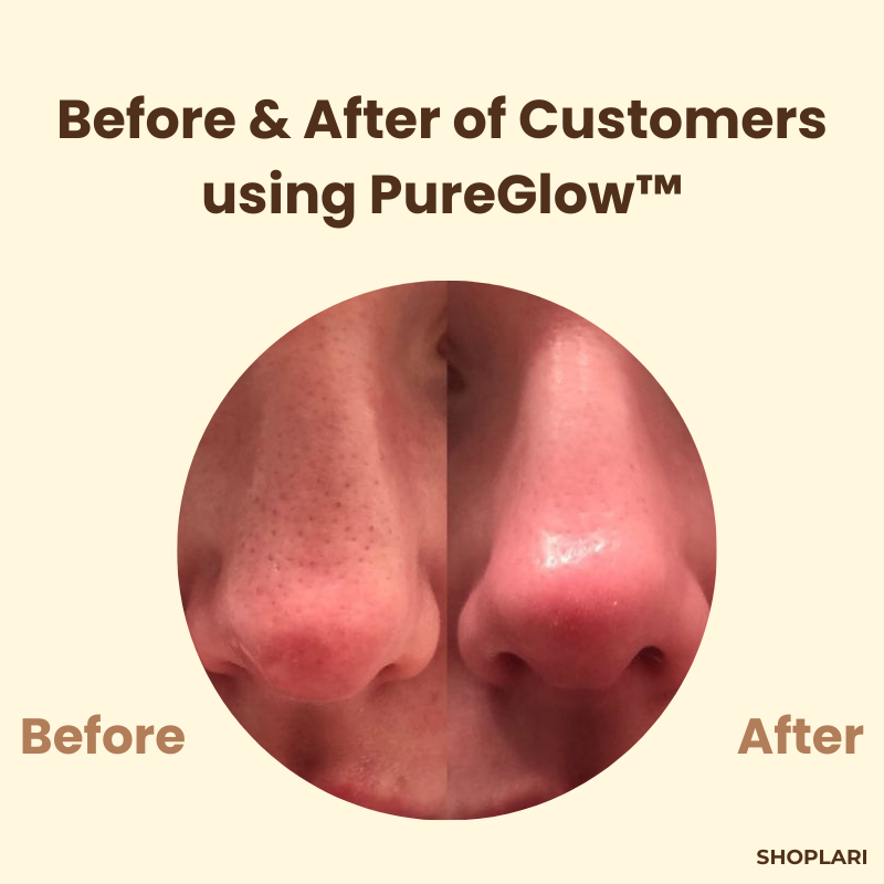 1+1 Free | PureGlow Black Tea Mask™ – Clear, youthful skin that exudes confidence