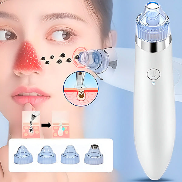 PureDerm™ - 2-in-1 Pore Cleaner And Microdermabrasion Device