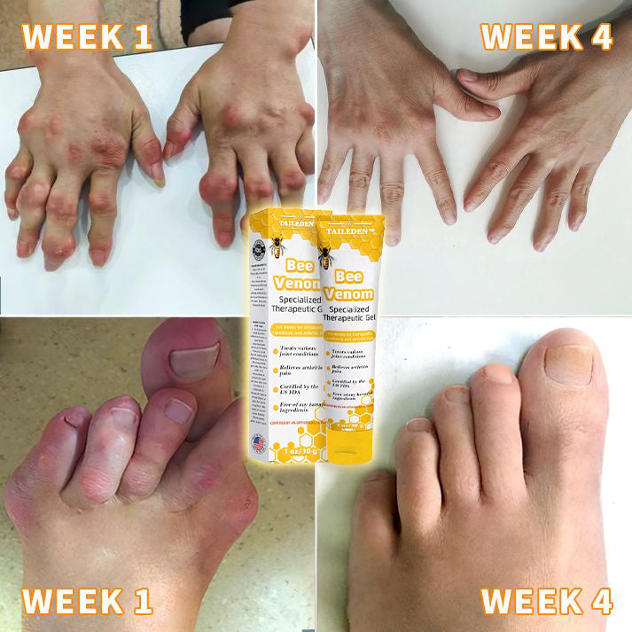 1+1 Free | TAILEDEN™ Bee Venom Joint Therapy Pain Gel – Relieve Pain and Regain Active Joy
