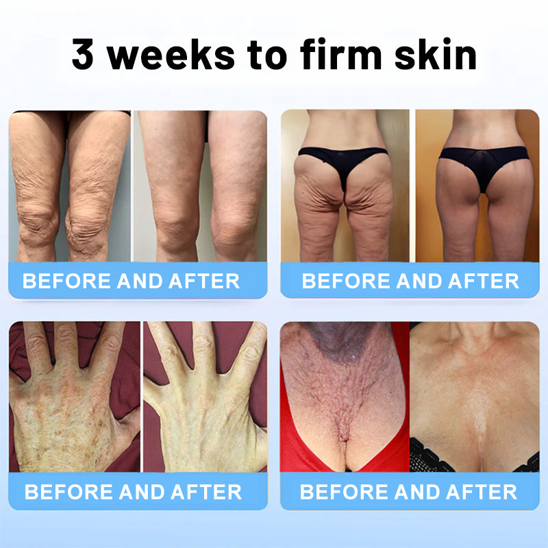 1 + 1 Free | Liftora™ - Luxurious Lifting Stick with Bee Venom and Peptides