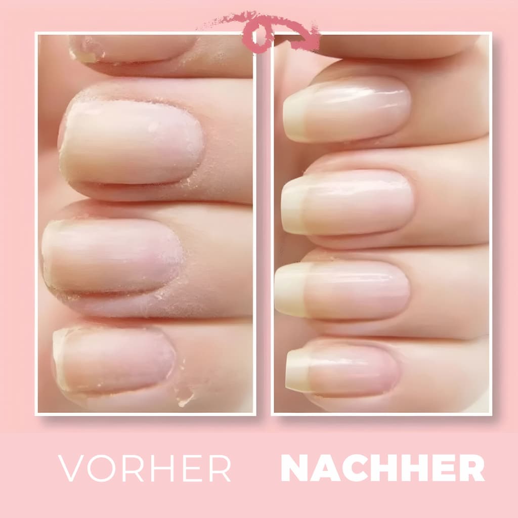 1+1 Free | NailWonder™ - Nail Repair Gel