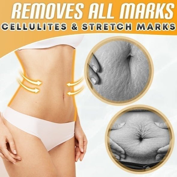 1+1 Free | Belly Drainage Ginger Oil - Made with natural oils to safely burn cellulite