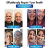 Futusly™ - Blue Light Curing Lamp and Denture Materials