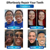 Futusly™ - Blue Light Curing Lamp and Denture Materials