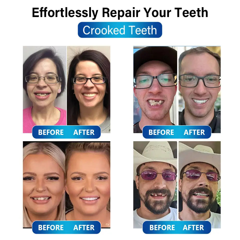 Futusly™ - Blue Light Curing Lamp and Denture Materials