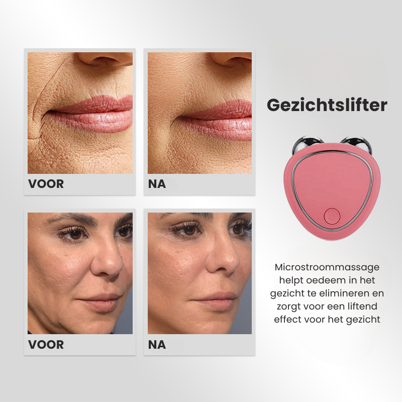 YouthNourish™ - Facial Massage Device